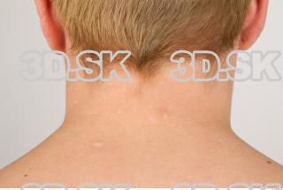 Neck texture of Pat 0006